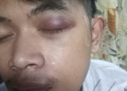 Lurah Balung Garut Diduga Menghalangi Proses Hukum Terkait Kasus Kekerasan.