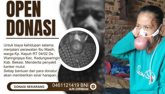Lidahnya Terus Membesar, Kesulitan Makan, Lengkap Sudah Penderitaan Masih Warga Desa Waringinjaya