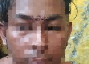 Polsek Sapeken Mandul 4 Pelaku Tidak Ditangkap, Atas Dugaan Penganiayaan Firdausi(Korban)